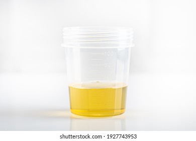 Laboratory Cup For The Biological Urine Test  Without Cap (open)