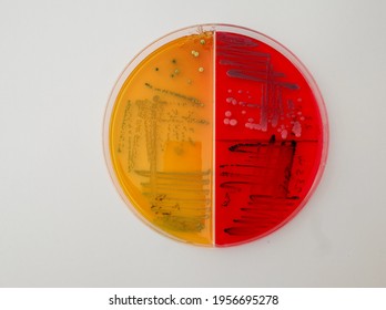 laboratory dish contain growth of colored bacterial colonies on differential agar media