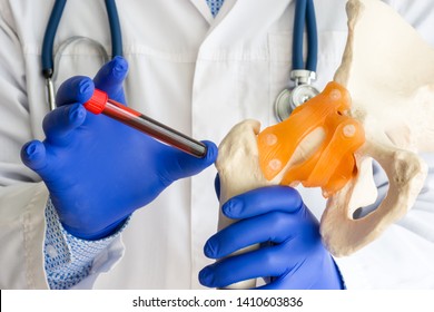Laboratory medical diagnostics, tests for bones and joint concept photo. Doctor or laboratory technician holds in one hand laboratory test tube with blood, in other hand - model of bone and hip joint