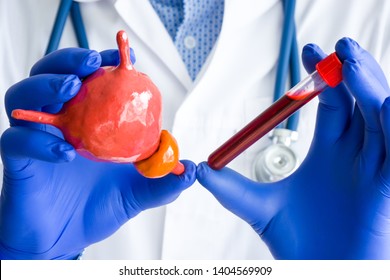 Laboratory medical diagnostics, tests and hormones for bladder and prostate  concept photo. Doctor or laboratory technician holds in one hand laboratory test tube with blood, in other hand - organ