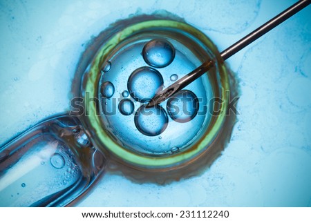 Laboratory microscopic research or IVF macro concept