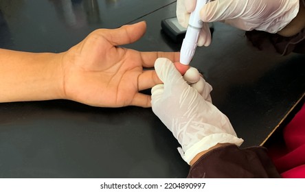 Laboratory Personnel Prick The Patient's Finger With A Sterile Lancet. Blood Glucose Control Concept. Closeup Photo