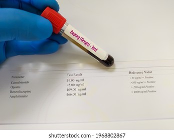 Laboratory sample of blood for doping drugs test. Doping is the used of banned athletic performance enhancing drug by athlete in competitive sport. Medical test in sport  with testing result 