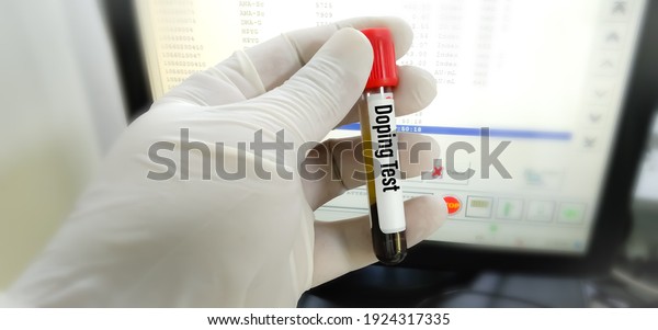 Laboratory\
sample of blood for doping drugs test. Doping is the used of banned\
athletic performance enhancing drug by athlete in competitive\
sport. Medical test in sport medicine\
concept.