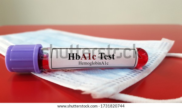 Laboratory sample tube of glycalated hemoglobin or hemoglobin A1C test(HbA1C). This blood sugar level used for diagnosis Diabetes mellitus disease(DM) and glycemic control in patient. Medical concept