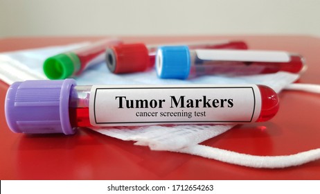 Tumor Marker Images, Stock Photos & Vectors | Shutterstock