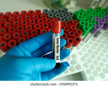 Laboratory Sample Of Tumor Markers Test For Diagnosis Cancer. Cancer Test Aim To Screening,early Detection Before Spread(metastasis). Malignancy Oncology Investigation At Medical Laboratory