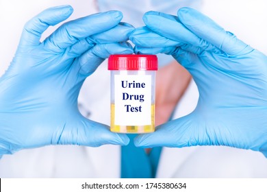 Laboratory Sample Of Urine For Drugs Or Substance Test. Drug Test Is Technical Analysis Of Specimen To Determine Illegal Drug Abuse As Cannabis, Cocaine, Methamphetamine, Heroin And Alcohol Level.