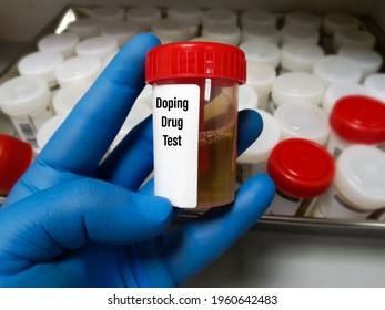 Laboratory Sample Of Urine For Drugs Or Substance Test. Drug Test Is Technical Analysis Of Specimen To Determine Illegal Drug Abuse As Cannabis, Cocaine, Methamphetamine, Heroin And Alcohol Level.