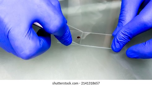 Laboratory Technician Preparing Blood Smear Blood Stock Photo ...