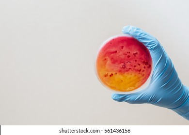 Laboratory Technician Tests For Bacterial Infection Analyzes Bacterial Colonies Growth Lab Worker's Hand Holds Test Sample In Petri Dishes Medical Hospital Research Disease Outbreak Control Prevention