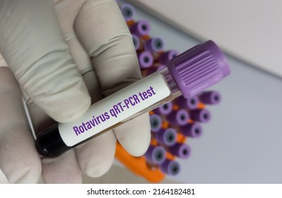 Laboratory Technologist Hold Blood Sample For Rota Virus QRT-PCR Test.