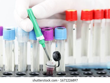 Laboratory Tests For Coronavirus Disease (COVID-19). Coronavirus Disease (COVID-19) Is An Infectious Disease Caused By A New Virus That Had Not Been Previously Identified In Humans.