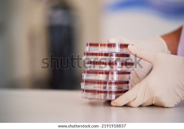 Laboratory worker\
holding a culture plate with bacteria or viruses growing on agar in\
petri dish for making a blood culture in a petri dish, Laboratory\
and Medical\
concepts.