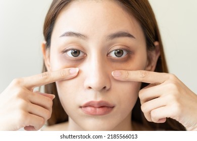 lack of sleep problem,  Worried Asian young woman pointing finger at dark circles under her eyes - Shutterstock ID 2185566013