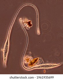 Lacrymaria, Portrait Of Two Ciliates (Ciliophora, Protista) Showing Cell Shape, Cell Flexibility, Cilia, Proboscis For Feeding; Phase Contrast Microscopy