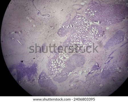 Lactating adenoma. Cribriform pattern, vacuola cytoplasm. Low power field.