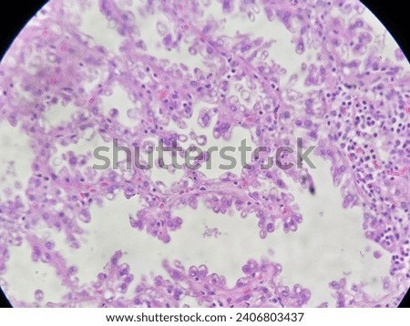 Lactating adenoma. Cribriform pattern, vacuola cytoplasm. High power field.