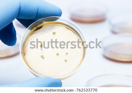 Lactobacillus bacteria colonies. A gloved hand holding a Petri dish that contains Gram-positive lactobacillus bacteria grown on agar. Lactobacillus is a common yogurt probiotic.