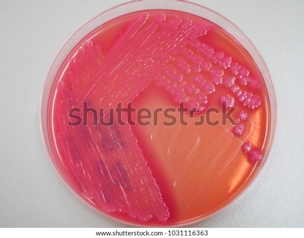 Lactose Fermentors Colonies Enteric Bacteria On Stock Photo 1031116363 ...