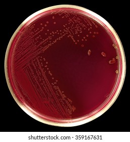 Lactose Positive Escherichia Coli Bacteria Grow Stock Photo 359167631 ...