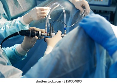 Laparoscope Tubes Hand Professional Surgeon Stock Photo 2159334893 ...