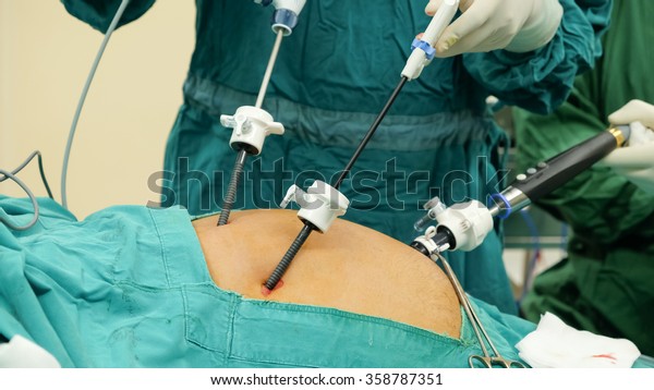 腹腔鏡下胆嚢摘出手術を意味する の写真素材 今すぐ編集 腹腔鏡下胆嚢摘出手術を意味する の写真素材 今すぐ編集