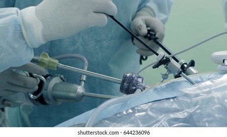 Laparoscopic Surgery Abdomen Team Medical Specialists Stock Photo ...