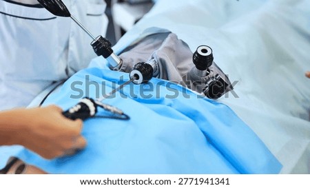 Laparoscopic surgery in progress, surgeon operating on a patient in operating room