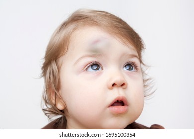 Bump Head Kid Images Stock Photos Vectors Shutterstock