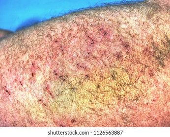 232 Hemoglobin in body skin Images, Stock Photos & Vectors | Shutterstock