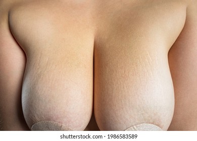 Large female breasts with nipple stickers isolated on white background, stretch marks on the skin, body care concept, close-up studio shot