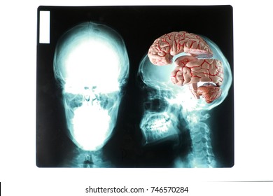  large human  genius brain  on x-ray picture of skull - model