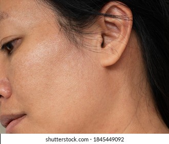 Large pores skin texture from an Asian woman face, imperfect skin concept 