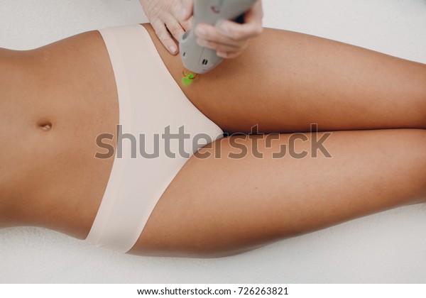 Laser Epilation Cosmetology Hair Removal Cosmetology Stock Photo Edit Now 726263821