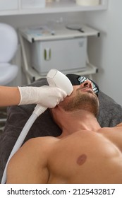 Laser Hair Removal On Mans Face. Man In A Goggles.