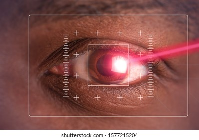 Laser Or Lasik Eye Surgery Concept, L Laser Beam Shining Into African America Male Dark Brown Eyes