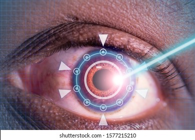 Laser Or Lasik Eye Surgery Concept, L Laser Beam Shining Into African America Male Dark Brown Eyes