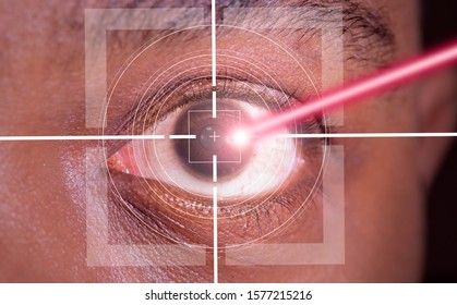 Laser Or Lasik Eye Surgery Concept, L Laser Beam Shining Into African America Male Dark Brown Eyes