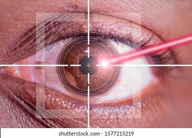 laser or lasik eye surgery concept, l laser beam shining into african america male dark brown eyes