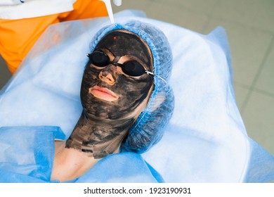 Laser Photorejuvenation And Carbon Peeling Of Face For Woman. Black Face Mask. Dermatology And Cosmetology. Using Surgical Laser.