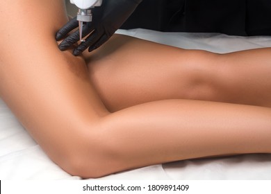 Dark Spots On Legs Stock Photos Images Photography Shutterstock