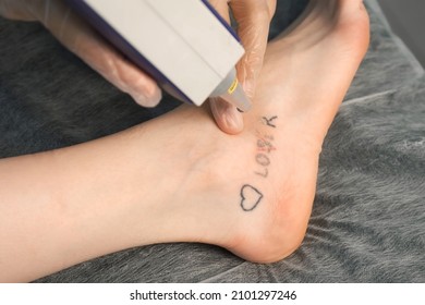 Laser Removing Of Tattoo With Words Loser, Lover And Heart On Woman's Foot In Red And Black Colours, Closeup Hands Of Doctor In Gloves. Romantic Tattoo Symbol Of Youth Love And Disappointment In Life.