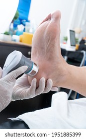 Laser Therapy On A Foot Used To Treat Pain. Selective Focus