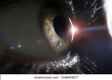 Laser Vision Correction Concept. Female Eye On Surgery Clinic Exam Closeup. Treatment For Astegmatism And Myopia