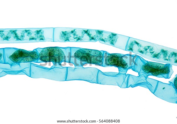 lateral-conjugation-of-spirogyra-algae-under-the-microscope