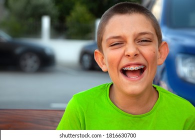 
Laughing Boy With Braces On His Teeth To Align His Teeth. Dental Concept.