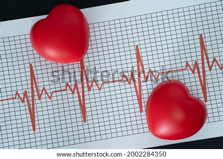 Layout of an electrocardiogram and two heart-shaped model on black background
