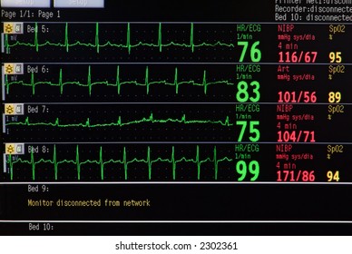 LCD Monitor In ICU For Several Patients