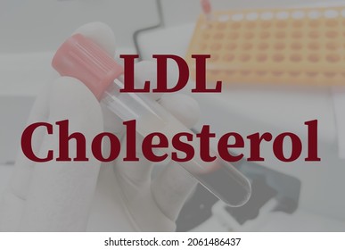 LDL Cholesterol Test With Laboratory Background, Low Density Lipoprotein